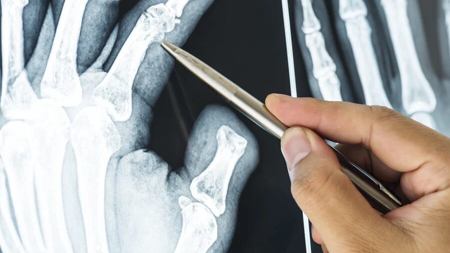 Gathering evidence of occupational injury claims or personal injury claims includes medical reports, photographs and witness statements.